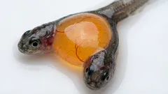 Kaksi päätä ja yksi ruumis: tutkijat löysivät sattumalta harvinaiset siamilaiset kaksoset